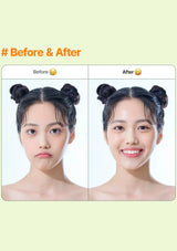 Before and after comparison of a woman's face, showing a puffy cheek on the left labeled 'Before' and a smoother, clearer face on the right labeled 'After' on a pale green background.