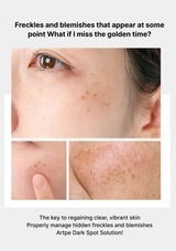 Close-up of skin with freckles and blemishes, accompanied by text about managing freckles and blemishes.
