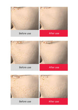 Before and after use comparison of a skincare product on skin texture.