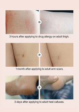 Before and after effects of applying a product to different parts of an adult's body.