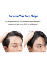 Before and after comparison of a person with an M-shaped hairline, showing the effect of hair covering on facial contour.
