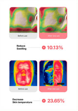 Before and after thermal imaging results showing swelling reduction and skin temperature decrease.