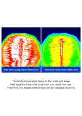 Two scalp heat detection images with text explaining hair loss and general scalp heat.