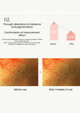 Before and after effect of a skincare product on melasma and pigmentation, with numerical data and human body application test details.