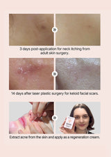 Before and after effects of a skincare product on skin with visible scars and itching.