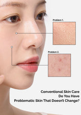 Close-up of a person's face with skin issues labeled, showing conventional skincare problems.