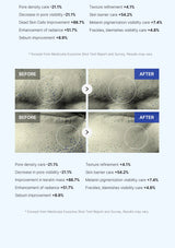 Before and after skin improvement results with text on a white background