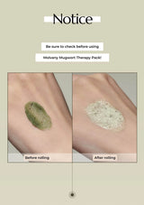 Before and after application of Molvany Mugwort Therapy Pack on skin