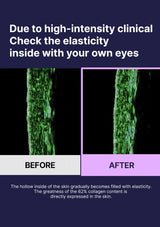 Before and after comparison of skin elasticity with text on a dark background