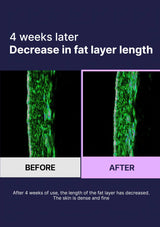 Before and after comparison of fat layer length reduction over 4 weeks with green and purple color coding.