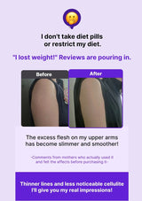 Before and after arm comparison with text about weight loss and cellulite reduction on a purple background.