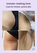 Original close-up photographs of uneven-looking inner-thigh, underarm and body skin