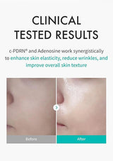 Advertisement for skin care product showing before and after effects with clinical text.