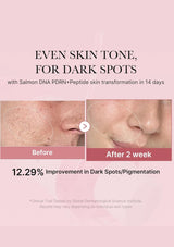 Before and after skin transformation with dark spot reduction, showing 12.29% improvement.