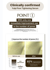 Advertisement for Yulpi Pore Tightening Serum with before and after effects on skin texture.
Advertisement for molvany Castanea Crenata Inner Shell Pore Tightening Serum featuring a woman holding the product.