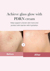 Before and after comparison of skin with PDRN cream application, showing improved skin texture.