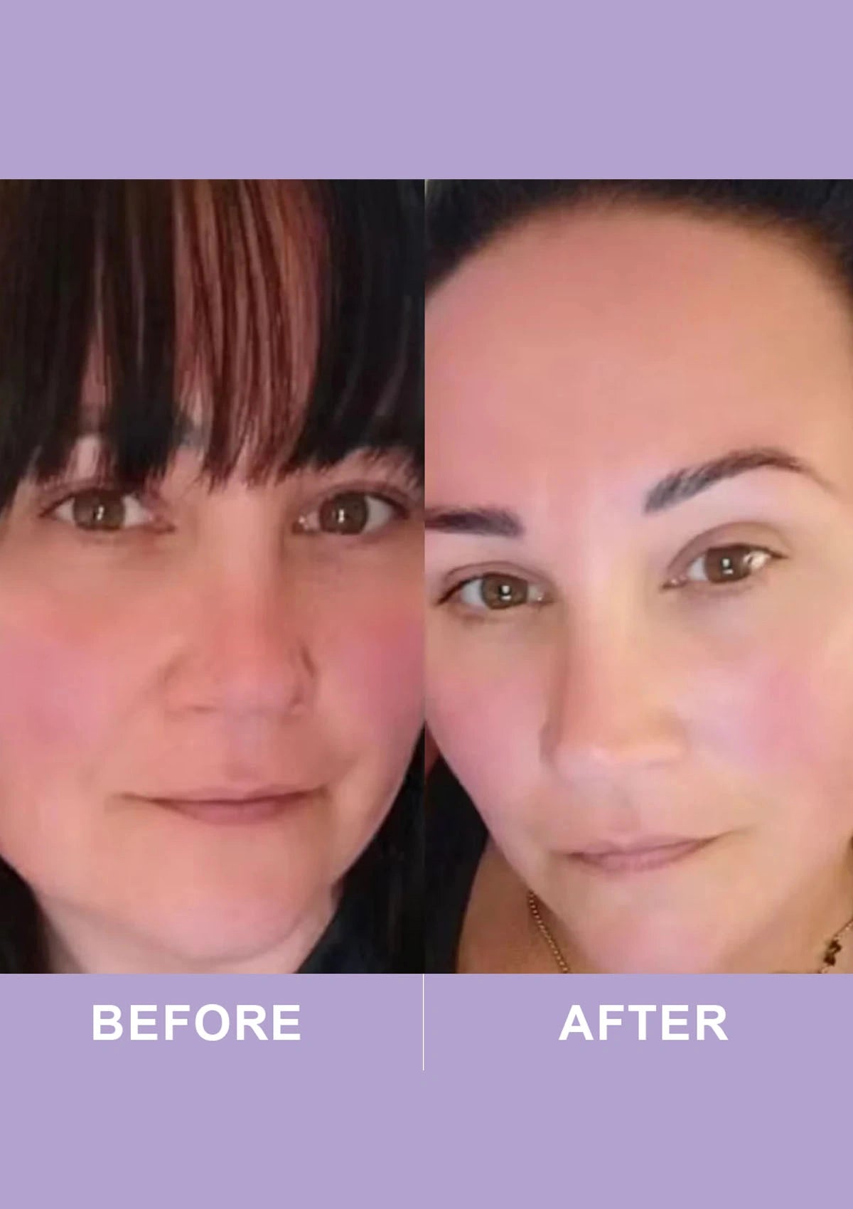 Before and after comparison of a woman's face with a purple background