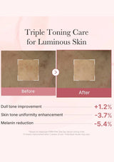 Before and after comparison of skin tone improvement with text on a pink background