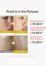 A before-and-after comparison graphic showing skin texture on a person's face, with text claiming a 75.06% reduction in pore impurities and other improvements after use over two weeks.