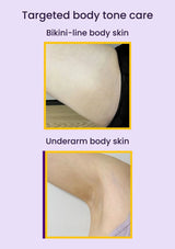 Original bikini-line and underarm body-skin result photographs, with English area labels