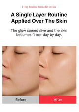 Before and after comparison of skin with DermalRix Cream, showing a single layer routine applied over the skin.