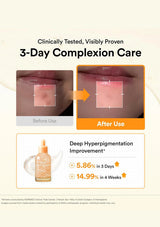 Promotional graphic for a 3-day complexion care product, showing before-and-after close-ups of lips with hyperpigmentation improvement, plus a bottle of serum with text claims.