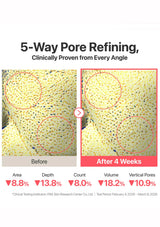 A before-and-after skincare comparison graphic for a 5-way pore refining treatment. The top text reads '5-Way Pore Refining, Clinically Proven from Every Angle.