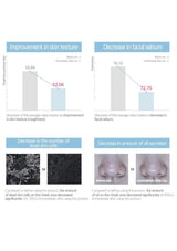 Graphs and images showing improvements in skin texture and sebum levels with a product.