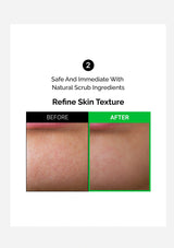Before and after comparison of a nose with text about waste discharge effect.