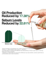 Hand holding a bottle with a dropper, showing oil production reduction and sebum levels decrease, with 'Before' and 'After' graphics.