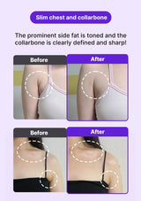 Before and after comparison of slim chest and collarbone with highlighted areas.