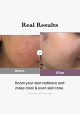 Before and after comparison of skin treatment with text 'Real Results' and 'Boost your skin radiance and make clear & even skin tone.'.