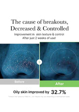 Before and after comparison of oily skin improvement with text on a white background