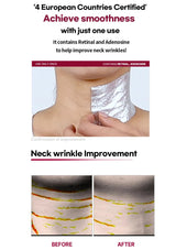 Advertisement for neck wrinkle improvement product showing before and after effects.