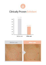 Before and after use comparison of a clinically proven exfoliant with a bar graph showing results.