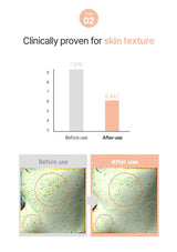 Before and after skin texture comparison with a bar graph showing clinical results.