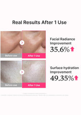 A promotional graphic showing before-and-after skin results after 1 use, with two pairs of close-up facial skin photos and text stating 'Real Results After 1 Use,' 'Facial Radiance Improvement 35.6%,' and 'Surface hydration Improvement 49.