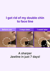 Before and after comparison of a double chin reduction treatment with text indicating results.