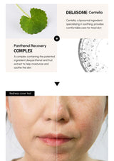 Skincare product advertisement with green leaf, text about Delasome Centella and Panthenol Recovery Complex, and a before-and-after skin comparison.