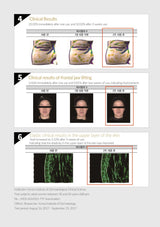 Clinical results of a skincare product with before-and-after images on a white background.