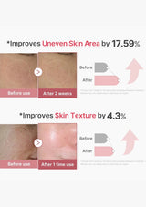Before and after skin improvement results with percentages shown on a white background