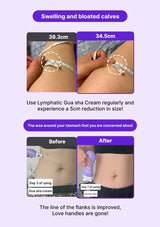 Advertisement for Lymphatic Gua sha Cream showing before and after effects on swelling and bloated calves.