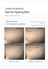 Before and after comparison of skin with pore tightening effect, showing improvement in pore size.