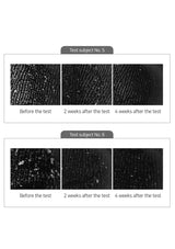 Before-and-after comparison of test subjects No. 5 and No. 6 with time frames indicated.