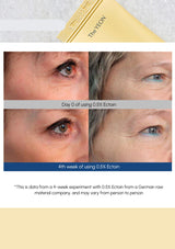 Before and after comparison of eye area skin texture with a product labeled 'The ECON' on a white background.