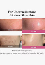 Before and after comparison of skin treatment for uneven skin tone and glass glow effect.