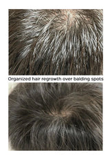 Top-down view of hair with organized hair regrowth over balding spots.