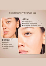 Cosmetic product advertisement with text 'Clinically Gentle, Visibly Restored' and images of a woman's face and skin.