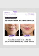 A promotional graphic for Aalok Q3 Rejuvenating Elasticity SKINMAX ESSENTIALs, showing a before-and-after comparison of a woman's cheek and mouth area to demonstrate skin tightening and dimension.