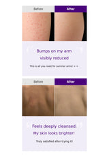 Before and after comparison of skin treatment on arms with text indicating reduced bumps and improved skin appearance.